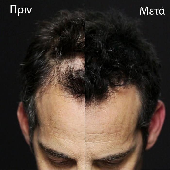 Toppik Ίνες Κερατίνης - Καστανό Σκούρο (55gr) φωτογραφία
