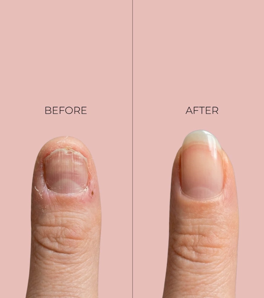 Peggy Sage Nail Care Stop & Grow Bitter-Tasting Protector (11ml) φωτογραφία