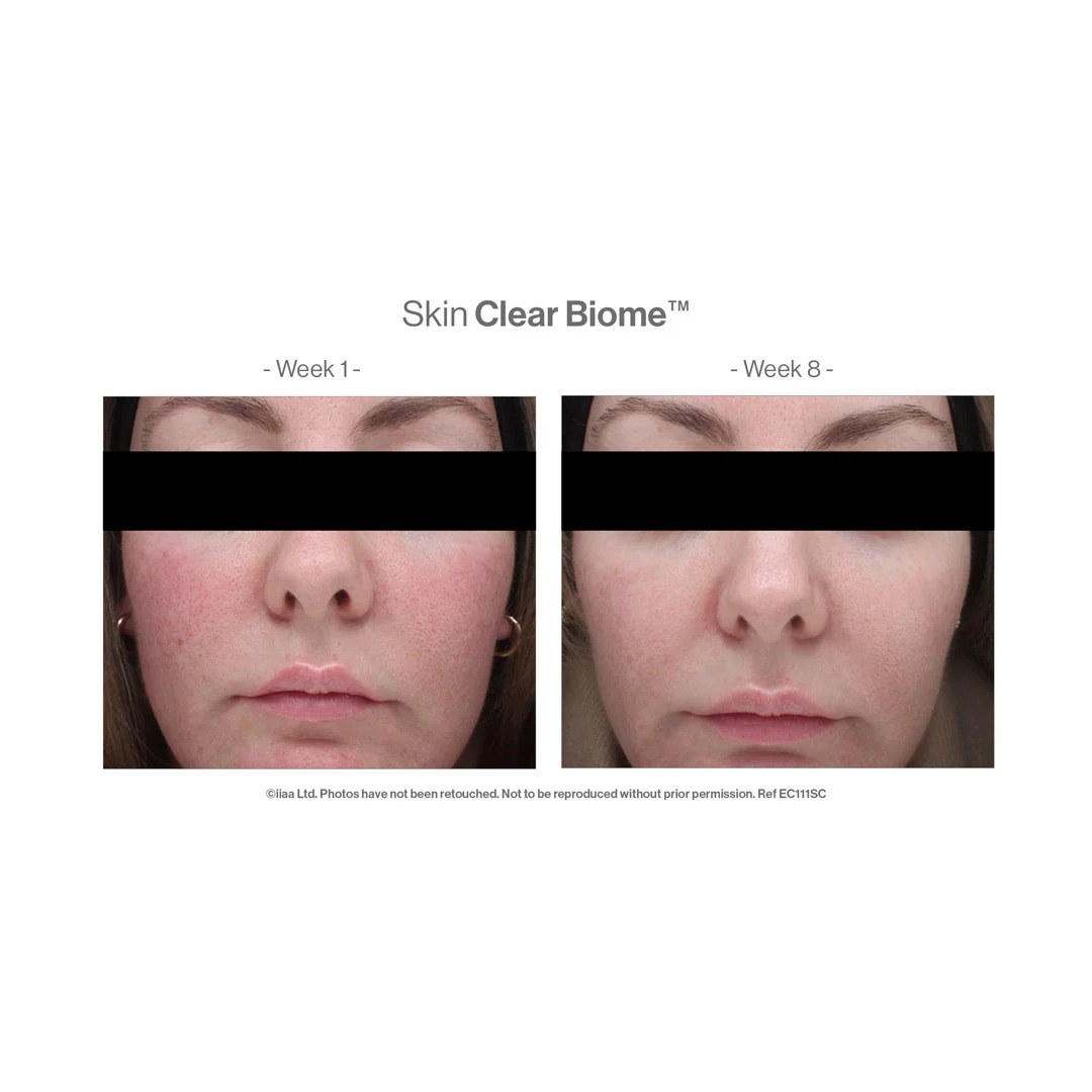 Advanced Nutrition Programme - Skin Clear Biome (60 caps) φωτογραφία