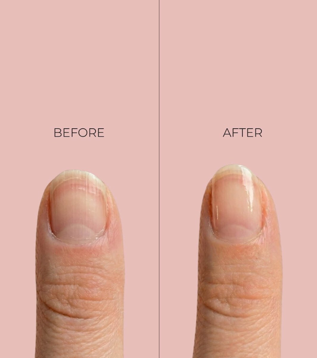Peggy Sage Nail Care Kera Bond Intensive Total Care (11ml) φωτογραφία