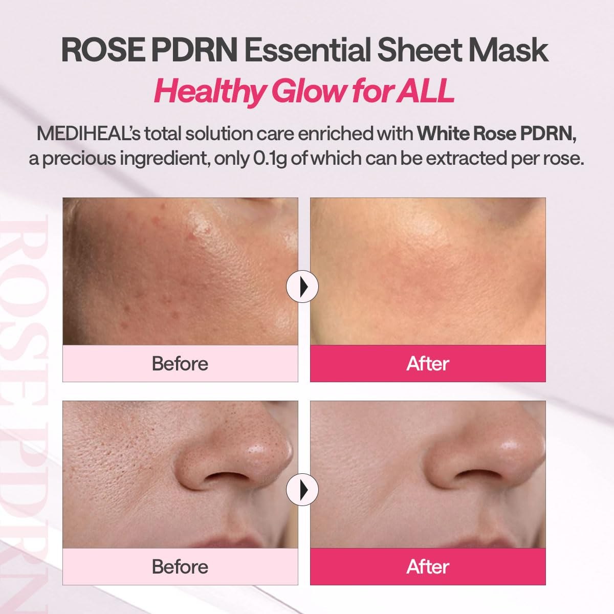 Mediheal Rose PDRN Healthy Glow Essential Mask (24ml) φωτογραφία