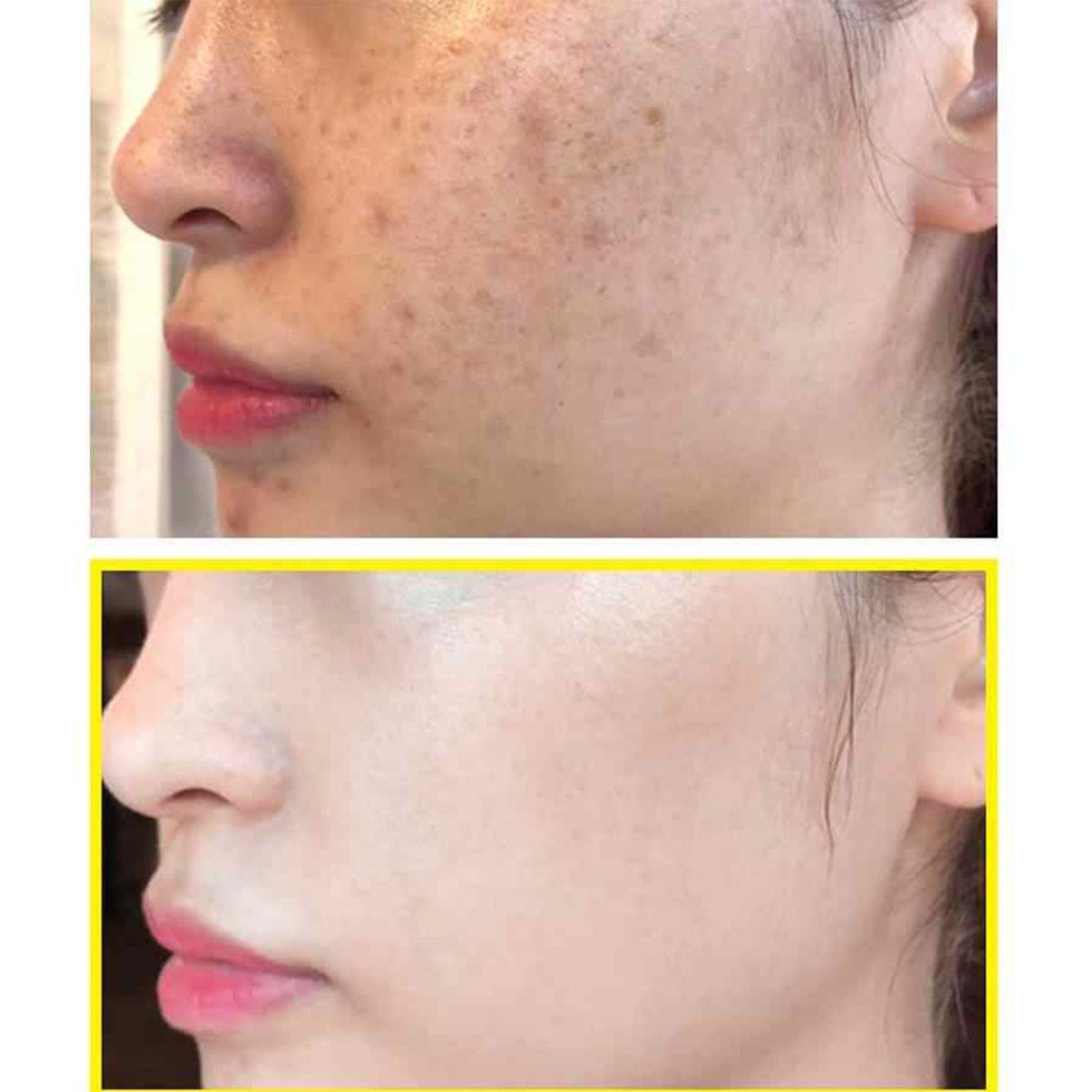 Some By Mi Yuja Niacin 30 Days Blemish Care Serum Sheet Mask (25g) φωτογραφία